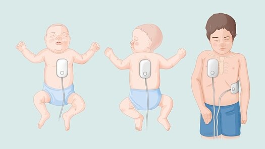Abbildung von 2 Babys und einem Kind mit einem Defibrillator